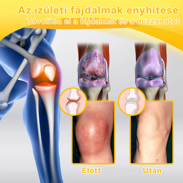 🌿🌿Laleia® Botulinum Toxin és Méhméreg Fájdalomcsillapító Csontgyógyító Krém🐝 (Kifejezetten időseknek & ortopéd szakorvosok ajánlásával)