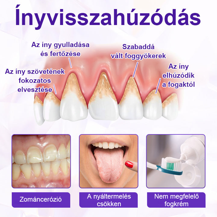 ⭐Laleia® SensiGum Fluoridos Fogkrém