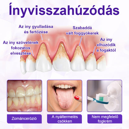 ⭐Laleia® SensiGum Fluoridos Fogkrém