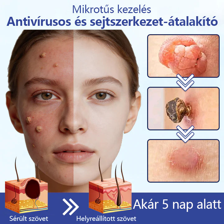 🔥 Laleia® DermalRepair 2 az 1-ben mikrotűs és hidrokolloid tapasz 💉