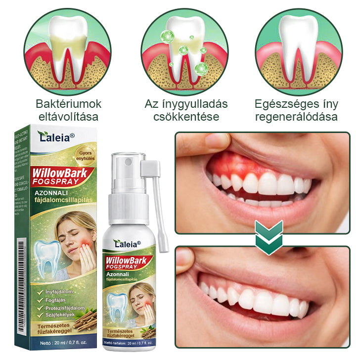 🌿Laleia® Fűzfakéreg Fogspray