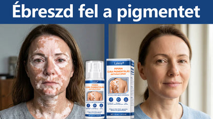 🌿🌿Laleia® Piperine Repigment Aktivátor Spray
