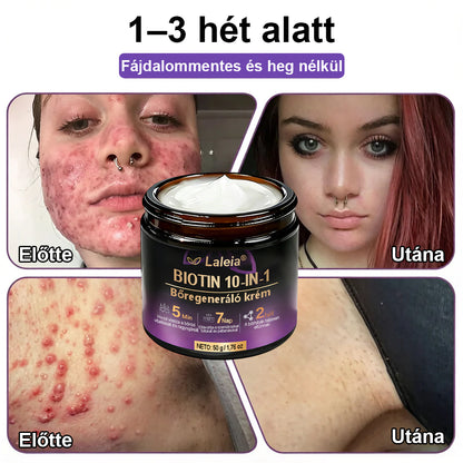 ✨Laleia® Biotin 10 az 1-ben bőr helyreállító krém