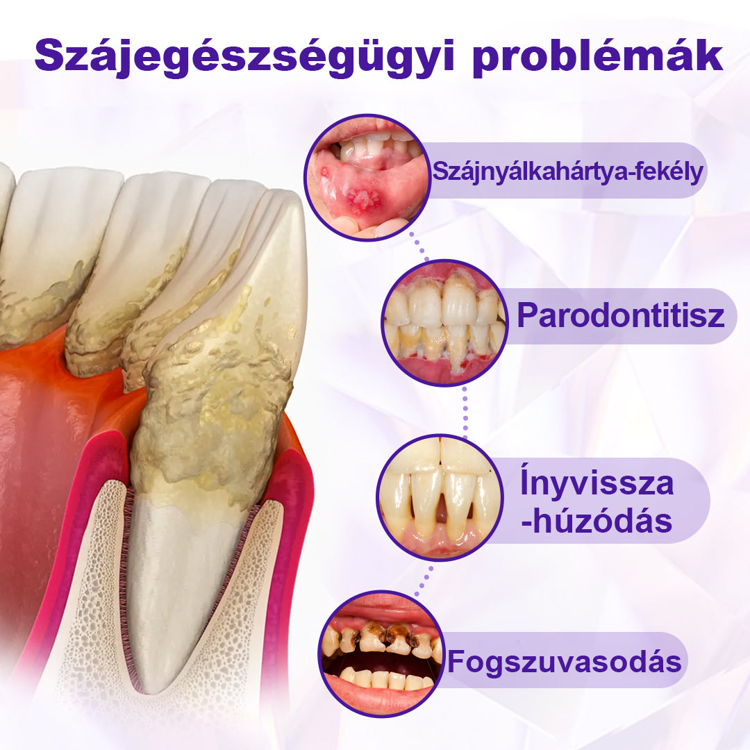 ⭐Laleia® SensiGum Fluoridos Fogkrém