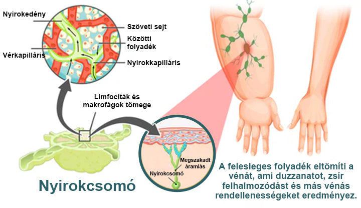 💎Laleia® Magnetológiás Moissanit Gyémánt Gyűrű