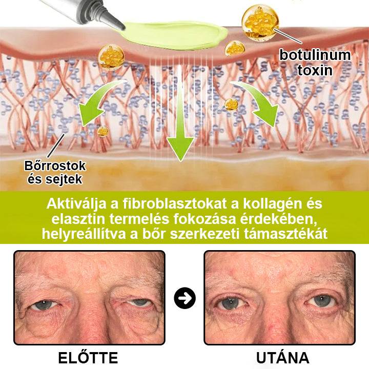 🌿🌿Laleia® Botox & Retinol Shot – Simaabb bőr mély ráncok, megereszkedett áll és duzzadt szemek ellen