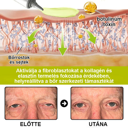 🌿🌿Laleia® Botox & Retinol Shot – Simaabb bőr mély ráncok, megereszkedett áll és duzzadt szemek ellen