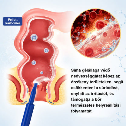 🌿 Timilk® ProctoEase nyugtató aranyérápoló gél