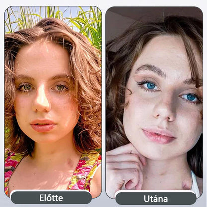 💧Laleia® EyeCandy Szemcseppek