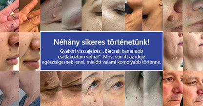🔥 Laleia® DermalRepair 2 az 1-ben mikrotűs és hidrokolloid tapasz 💉
