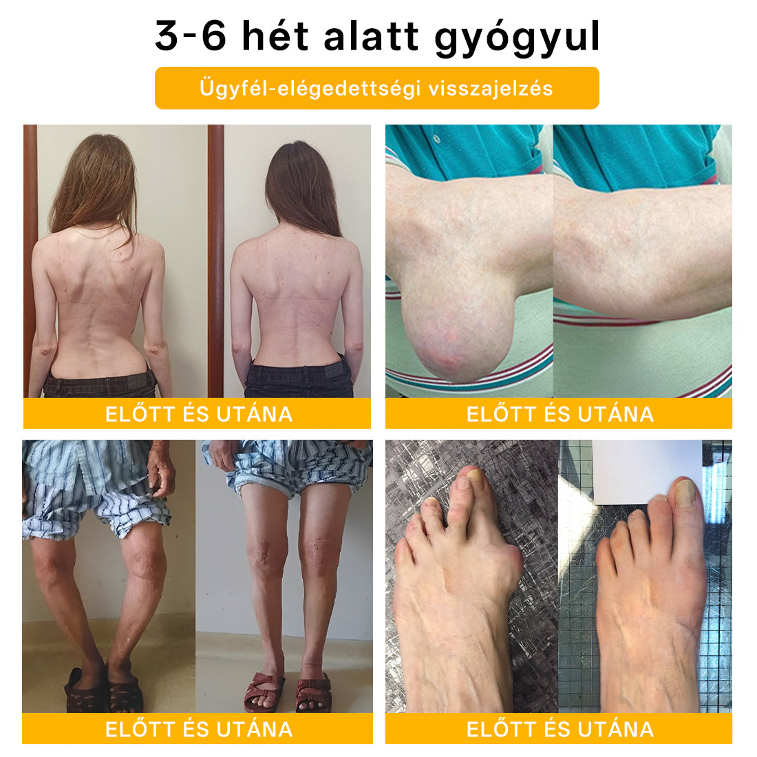 🌿🌿Laleia® Botulinum Toxin és Méhméreg Fájdalomcsillapító Csontgyógyító Krém🐝 (Kifejezetten időseknek & ortopéd szakorvosok ajánlásával)