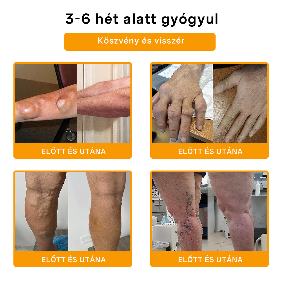 🌿🌿Laleia® Botulinum Toxin és Méhméreg Fájdalomcsillapító Csontgyógyító Krém🐝 (Kifejezetten időseknek & ortopéd szakorvosok ajánlásával)