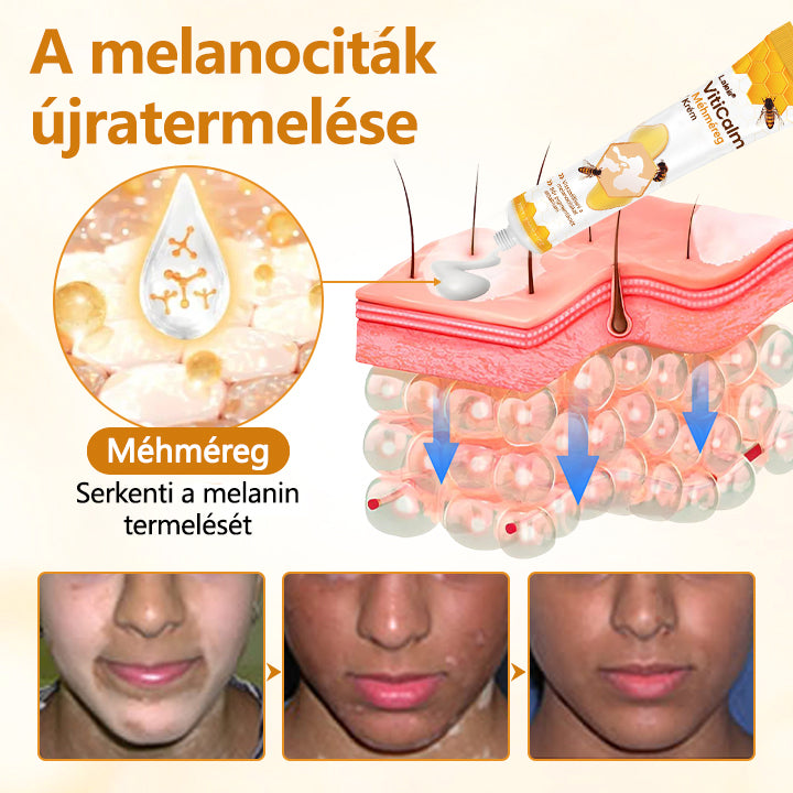 Laleia® VitiCalm méhméreg-krém🌻🌻