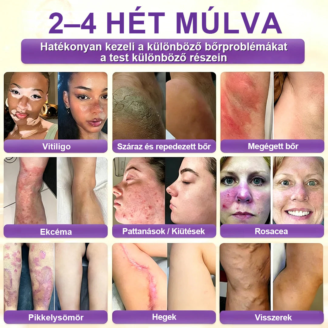 ✨Laleia® Biotin 10 az 1-ben bőr helyreállító krém