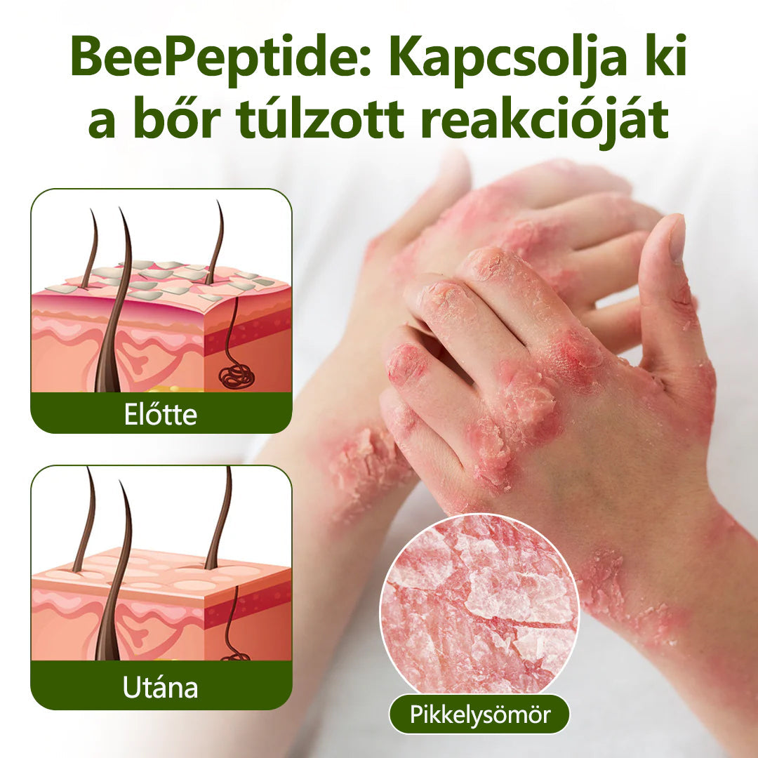 🔥🔥Laleia® MéhPeptid GyökérPuhító Kétirányú Megkönnyebbülés Krém