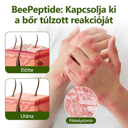 🔥🔥Laleia® MéhPeptid GyökérPuhító Kétirányú Megkönnyebbülés Krém