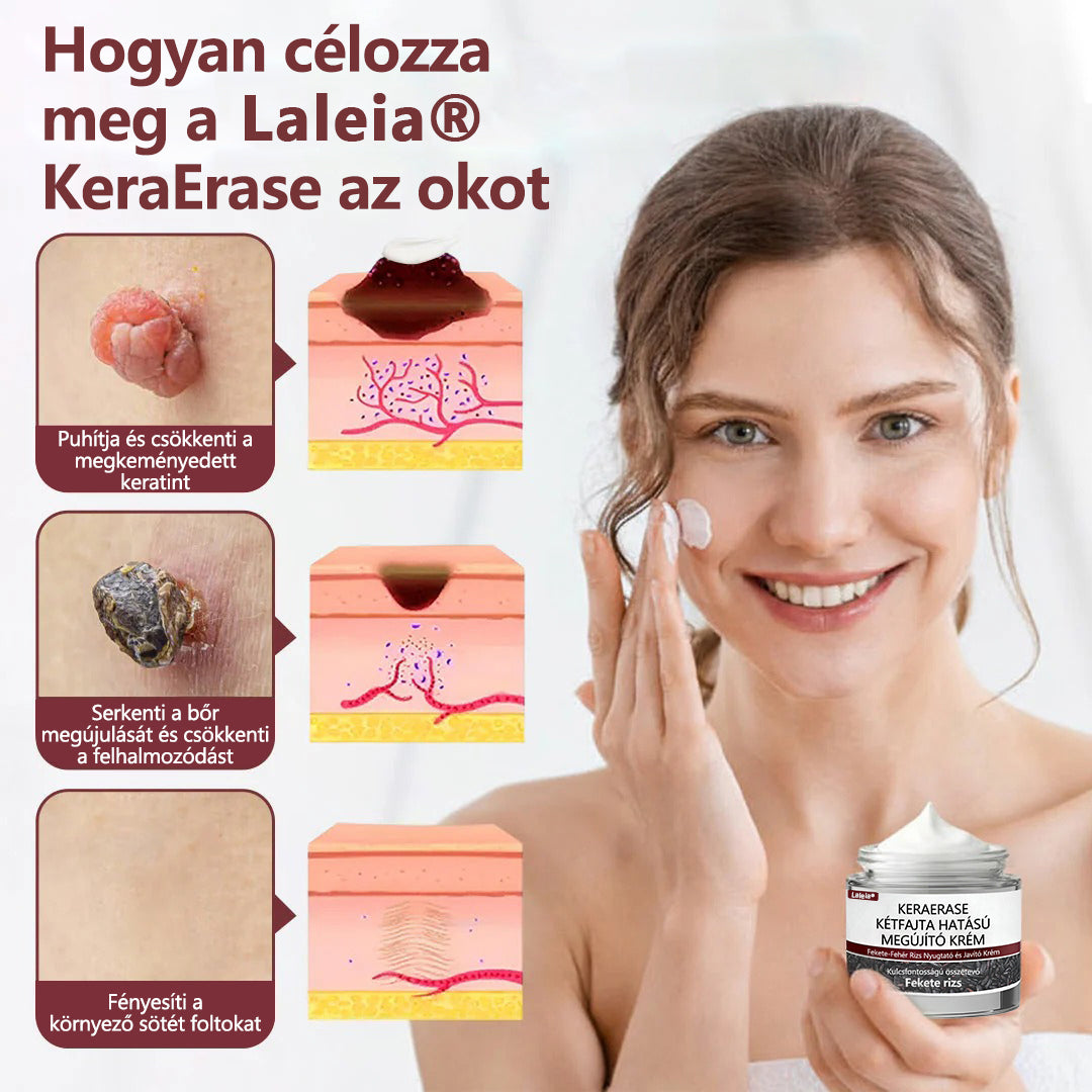 🔥🔥Laleia®KeraErase kettős hatású megújító krém