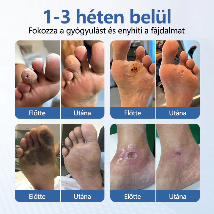 Laleia® VitaGluco Diabetes Treatment Cream