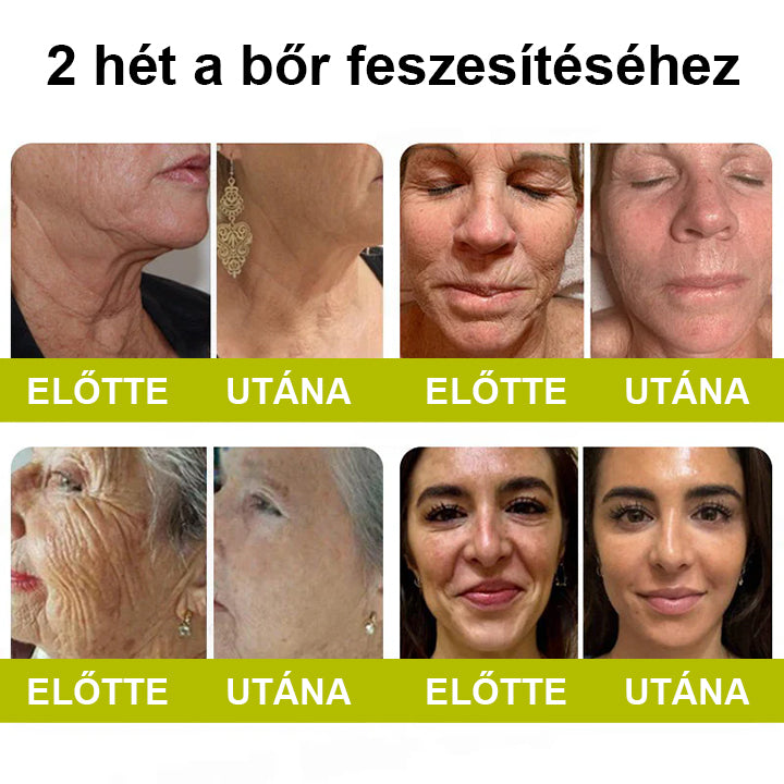 🌿🌿Laleia® Botox & Retinol Shot – Simaabb bőr mély ráncok, megereszkedett áll és duzzadt szemek ellen