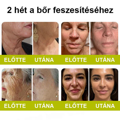 🌿🌿Laleia® Botox & Retinol Shot – Simaabb bőr mély ráncok, megereszkedett áll és duzzadt szemek ellen
