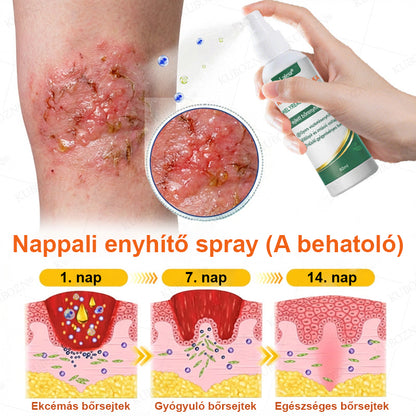 👩‍⚕️Laleia® Pikkelysömör Nappali és Éjszakai Javító Rendszer