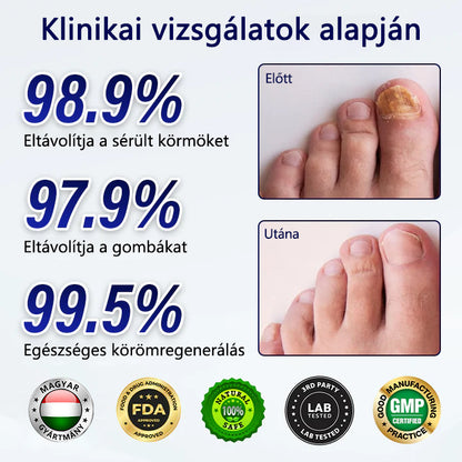 🔥🔥Laleia® Gombaellenes körömjavító tapasz