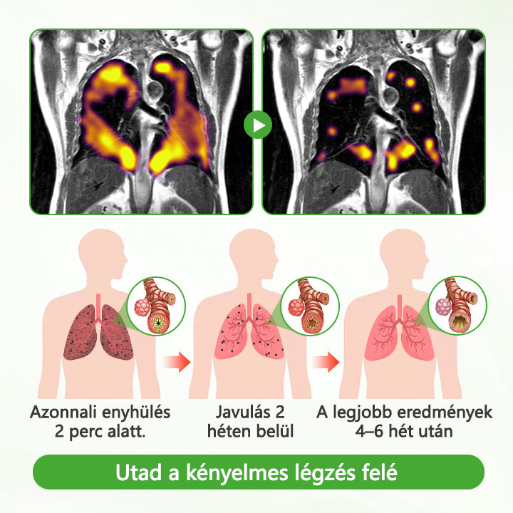 Laleia® Mulleaf gyógynövényes tüdőtisztító⭐