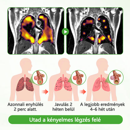 Laleia® Mulleaf gyógynövényes tüdőtisztító⭐