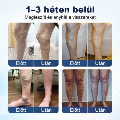 💎Laleia® Mélyvénás Javító Mikrotűs Tapasz