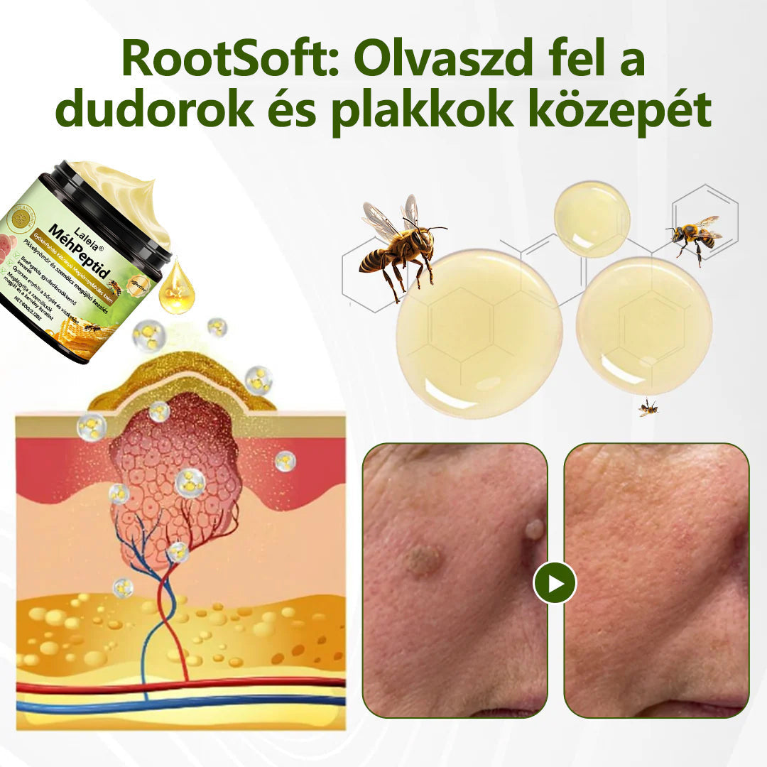 🔥🔥Laleia® MéhPeptid GyökérPuhító Kétirányú Megkönnyebbülés Krém