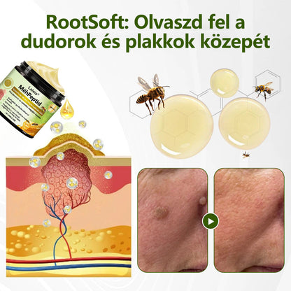 🔥🔥Laleia® MéhPeptid GyökérPuhító Kétirányú Megkönnyebbülés Krém