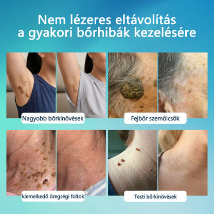Timilk® SpotlessPro Fejlett Bőrápoló Toll