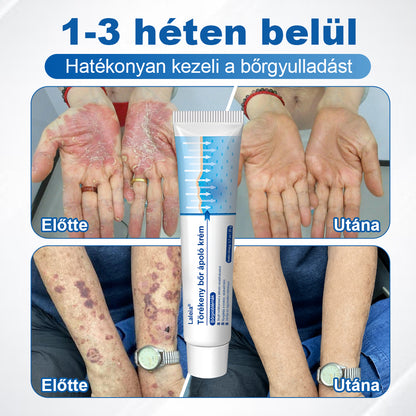 🌿🌿Laleia® Gyengéd Bőr Helyreállító Krém 🛡️