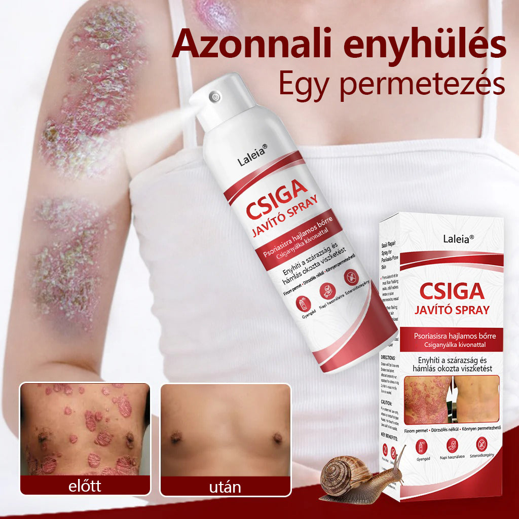 🔥🔥Laleia® csigahéjas spray viszkető, hámló pikkelysömörös bőrre