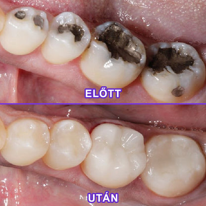 ⭐Laleia® SensiGum Fluoridos Fogkrém