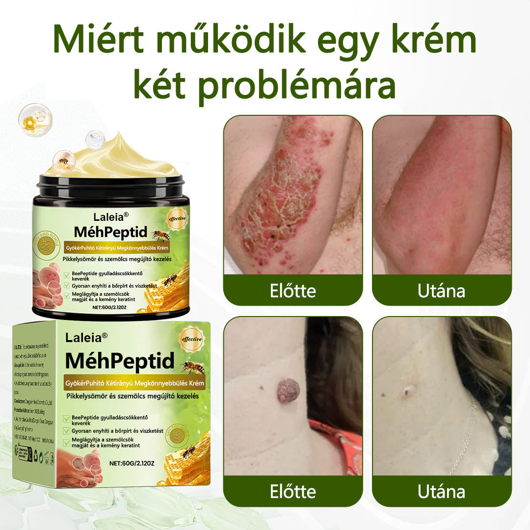🔥🔥Laleia® MéhPeptid GyökérPuhító Kétirányú Megkönnyebbülés Krém