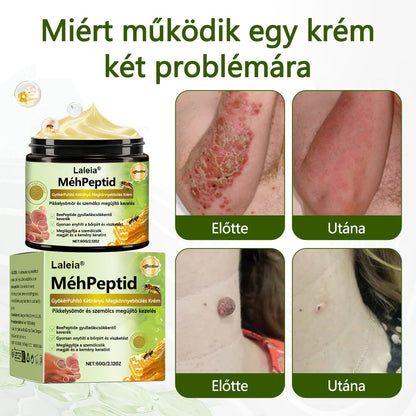 🔥🔥Laleia® MéhPeptid GyökérPuhító Kétirányú Megkönnyebbülés Krém