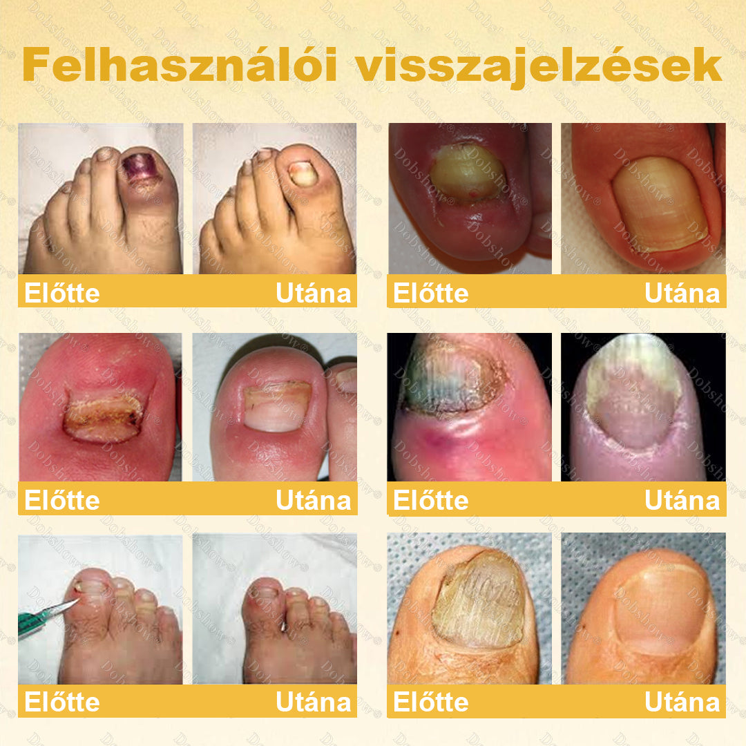 🌿 Laleia® Méhméreg Körömmentő Spray