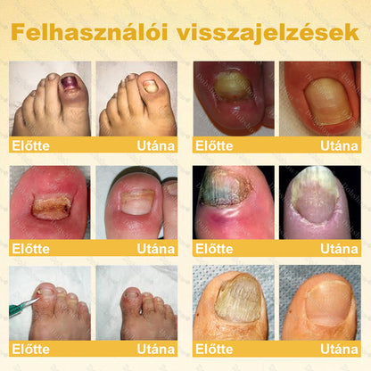 🌿 Laleia® Méhméreg Körömmentő Spray