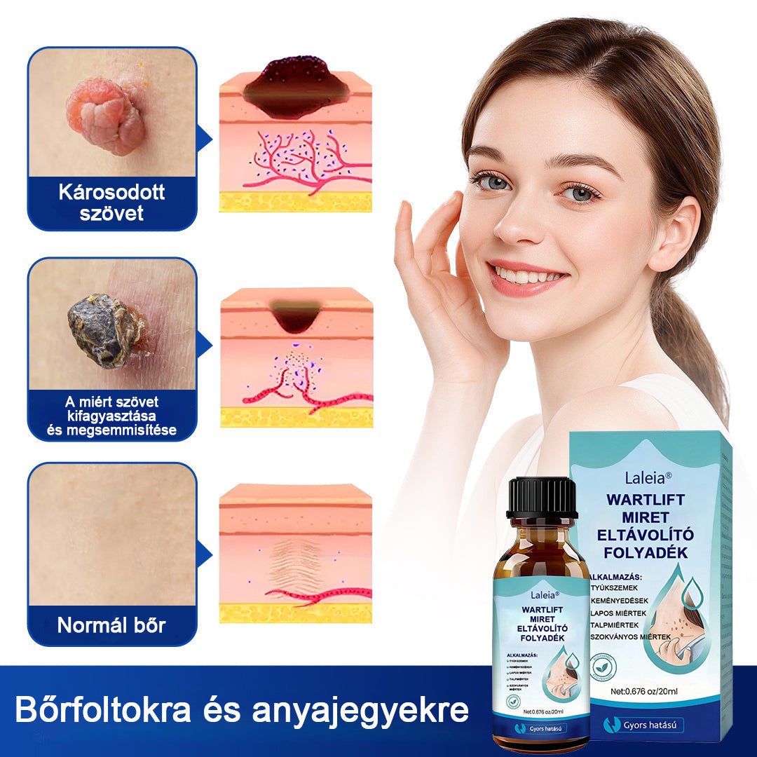 🔥🔥Laleia® WartLift tyúkszemeltávolító folyadék