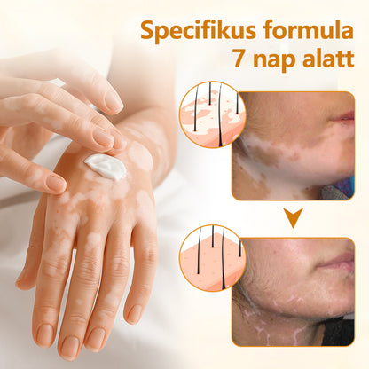 Laleia® VitiCalm méhméreg-krém🌻🌻