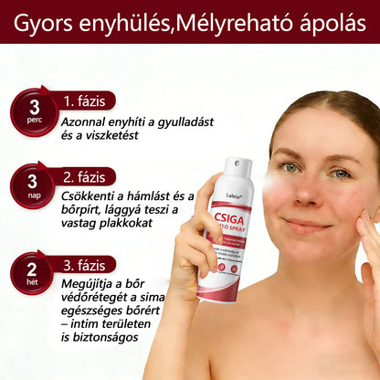 🔥🔥Laleia® csigahéjas spray viszkető, hámló pikkelysömörös bőrre