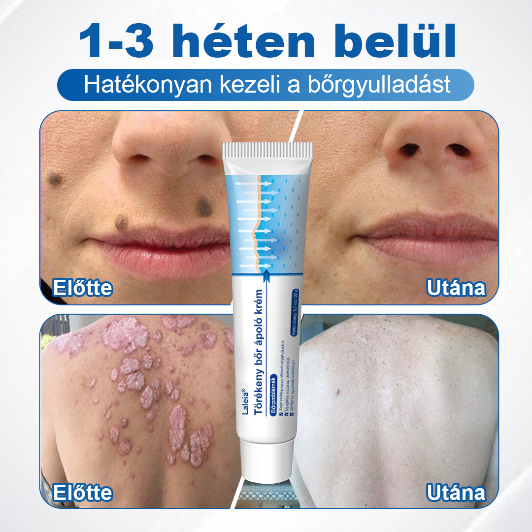 🌿🌿Laleia® Gyengéd Bőr Helyreállító Krém 🛡️