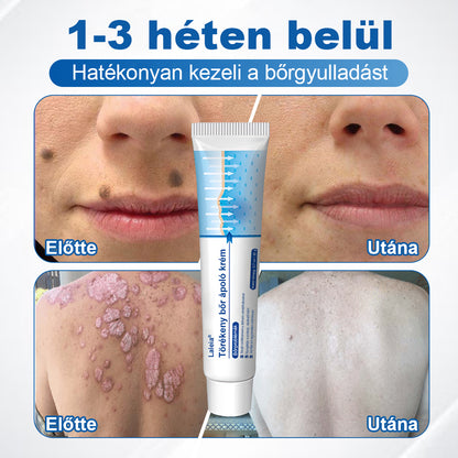🌿🌿Laleia® Gyengéd Bőr Helyreállító Krém 🛡️
