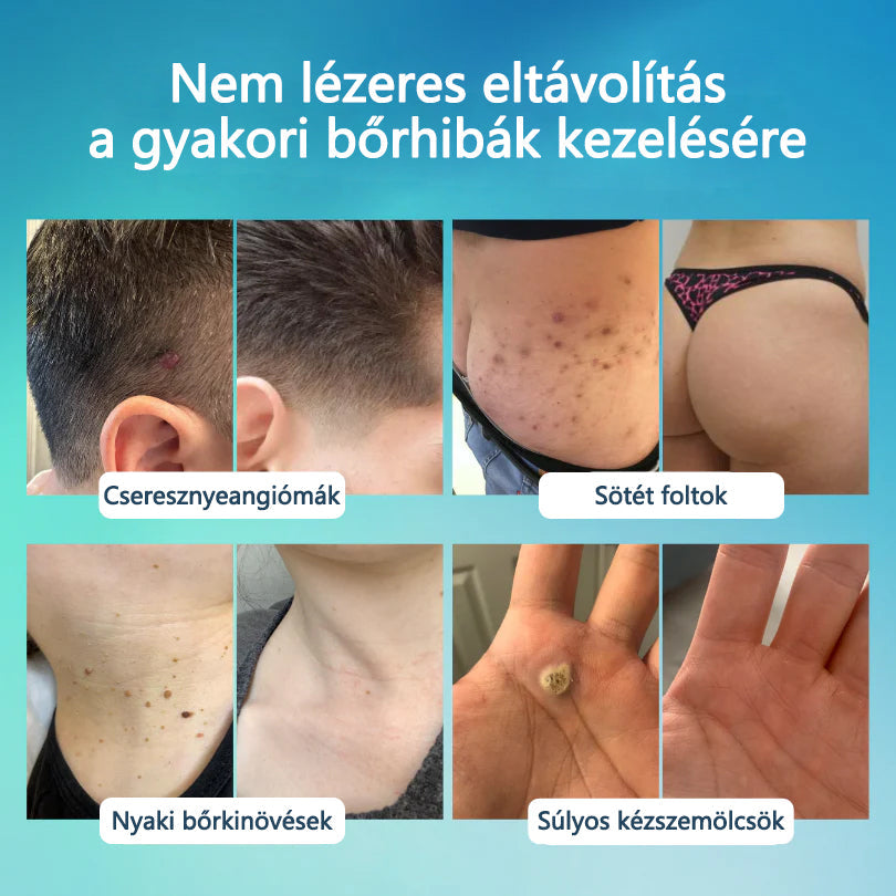 Timilk® SpotlessPro Fejlett Bőrápoló Toll