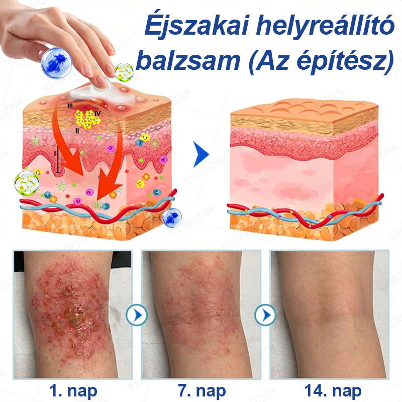👩‍⚕️Laleia® Pikkelysömör Nappali és Éjszakai Javító Rendszer
