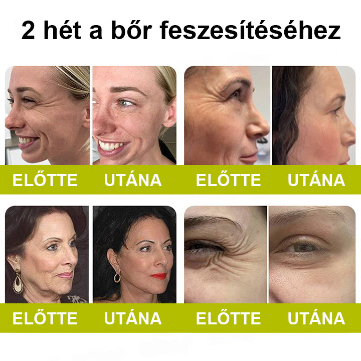 🌿🌿Laleia® Botox & Retinol Shot – Simaabb bőr mély ráncok, megereszkedett áll és duzzadt szemek ellen
