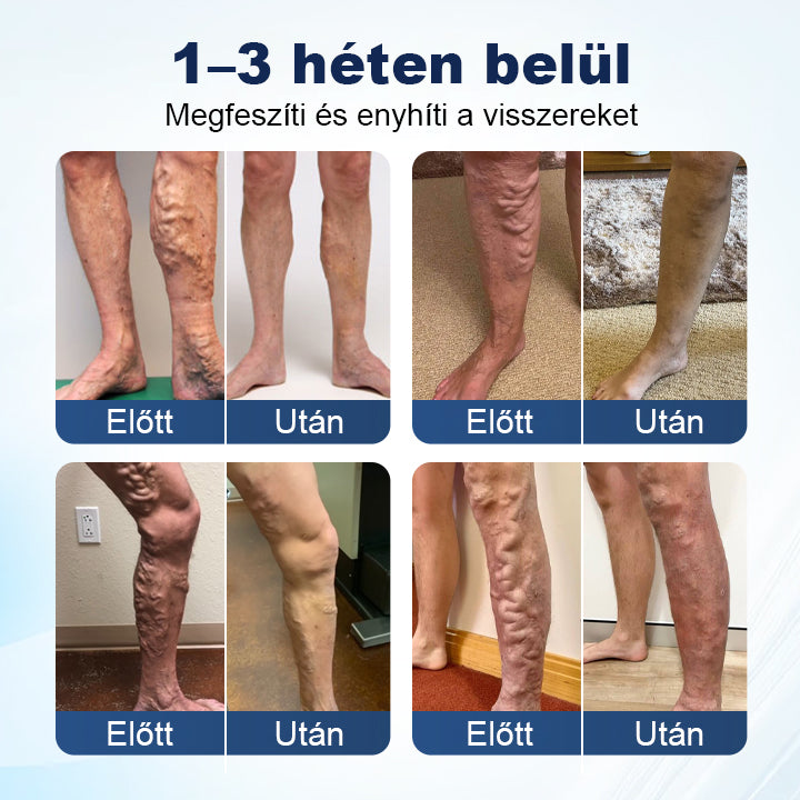 💎Laleia® Mélyvénás Javító Mikrotűs Tapasz