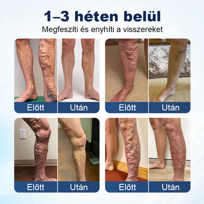 💎Laleia® Mélyvénás Javító Mikrotűs Tapasz
