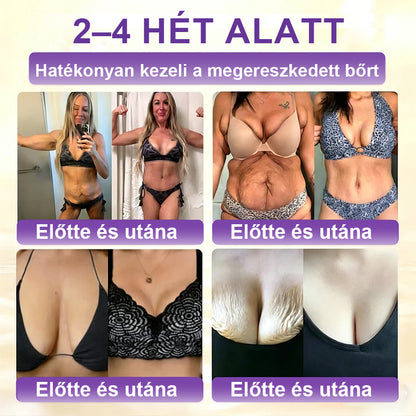 ✨Laleia® Biotin 10 az 1-ben bőr helyreállító krém